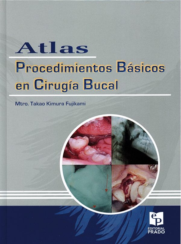 Atlas Procedimientos Básicos en Cirugía Bucal