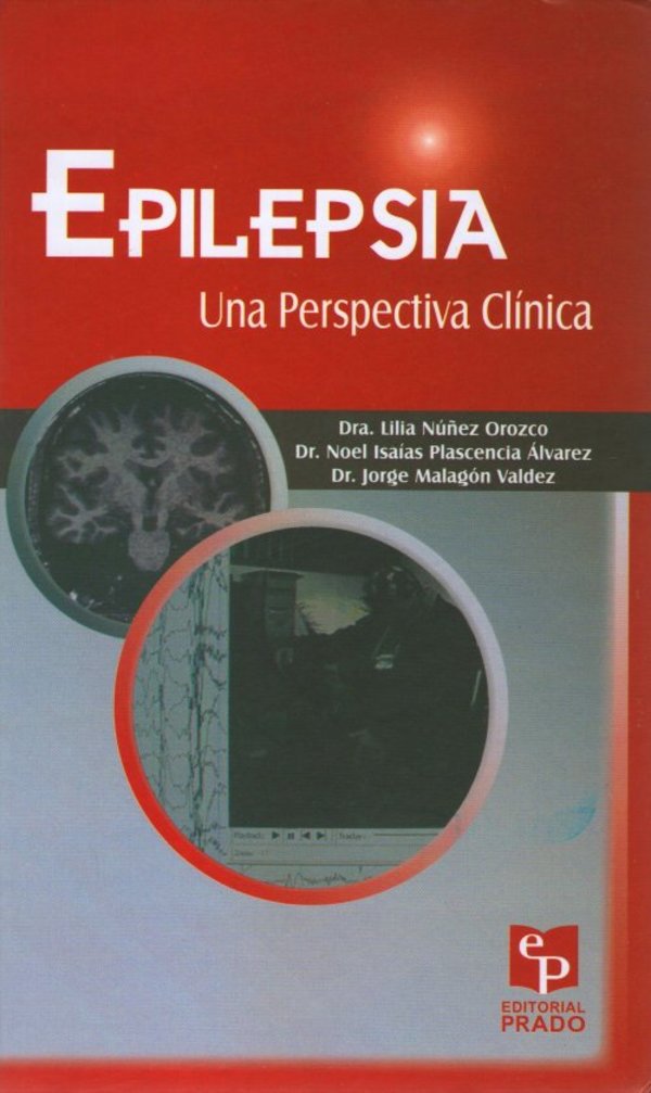 Epilepsia: Una Perspectiva Clínica