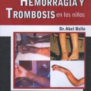 Hemorragia y trombosis en los niños