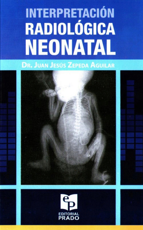 Interpretación radiológica neonatal