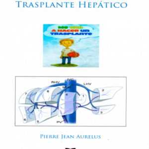 Trasplante hepático