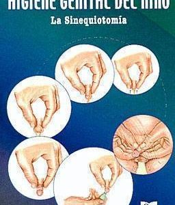 Higiene genital del niño: La sinequiotomía